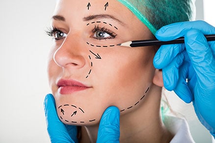 Ritidoplastia