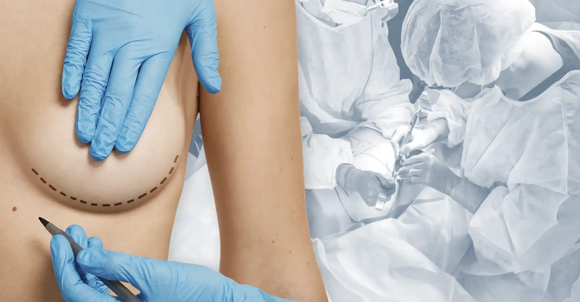 dr-ricardo-miranda-explante-de-silicone-2026